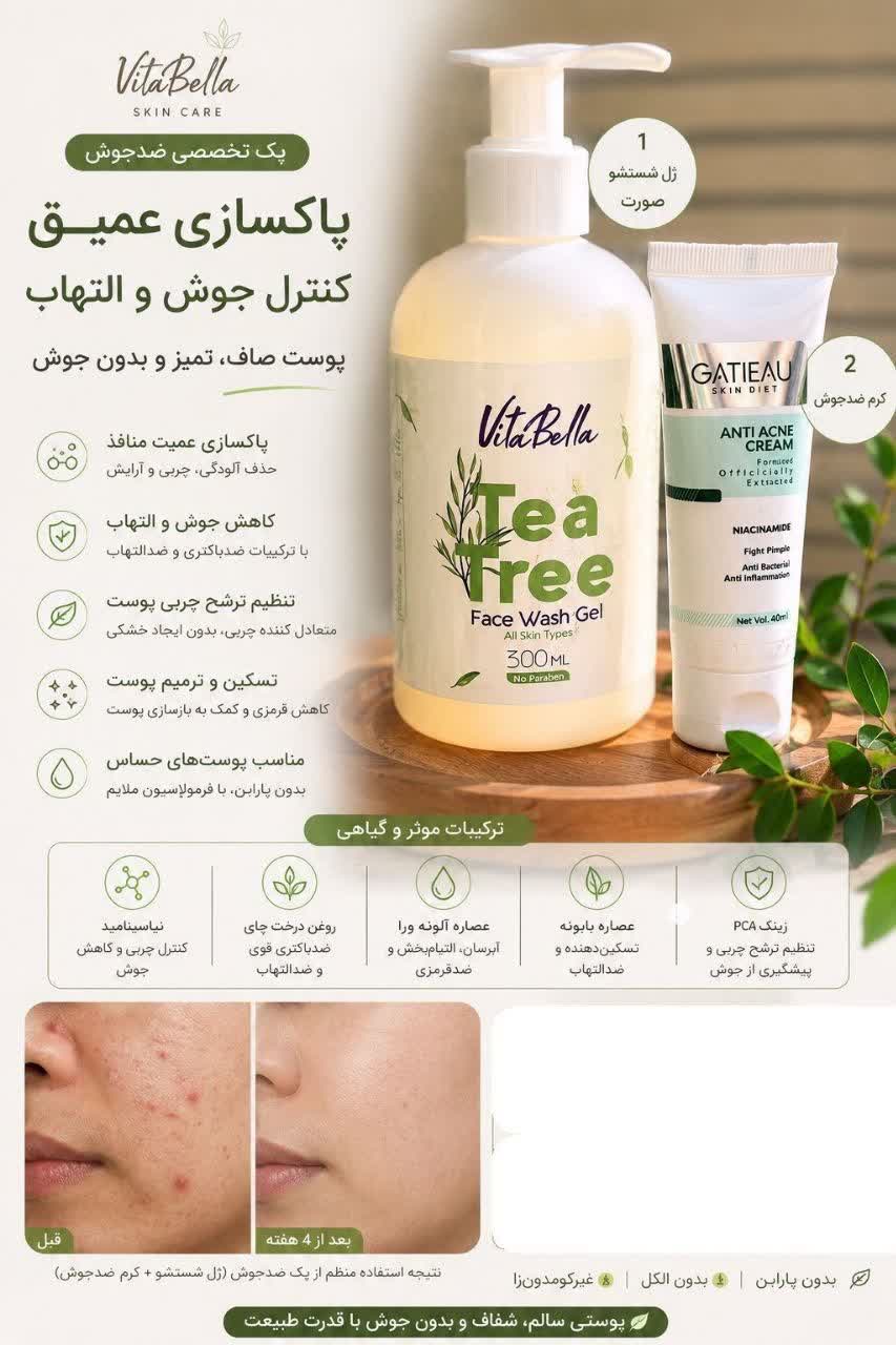 کرم ضد آکنه و جوش